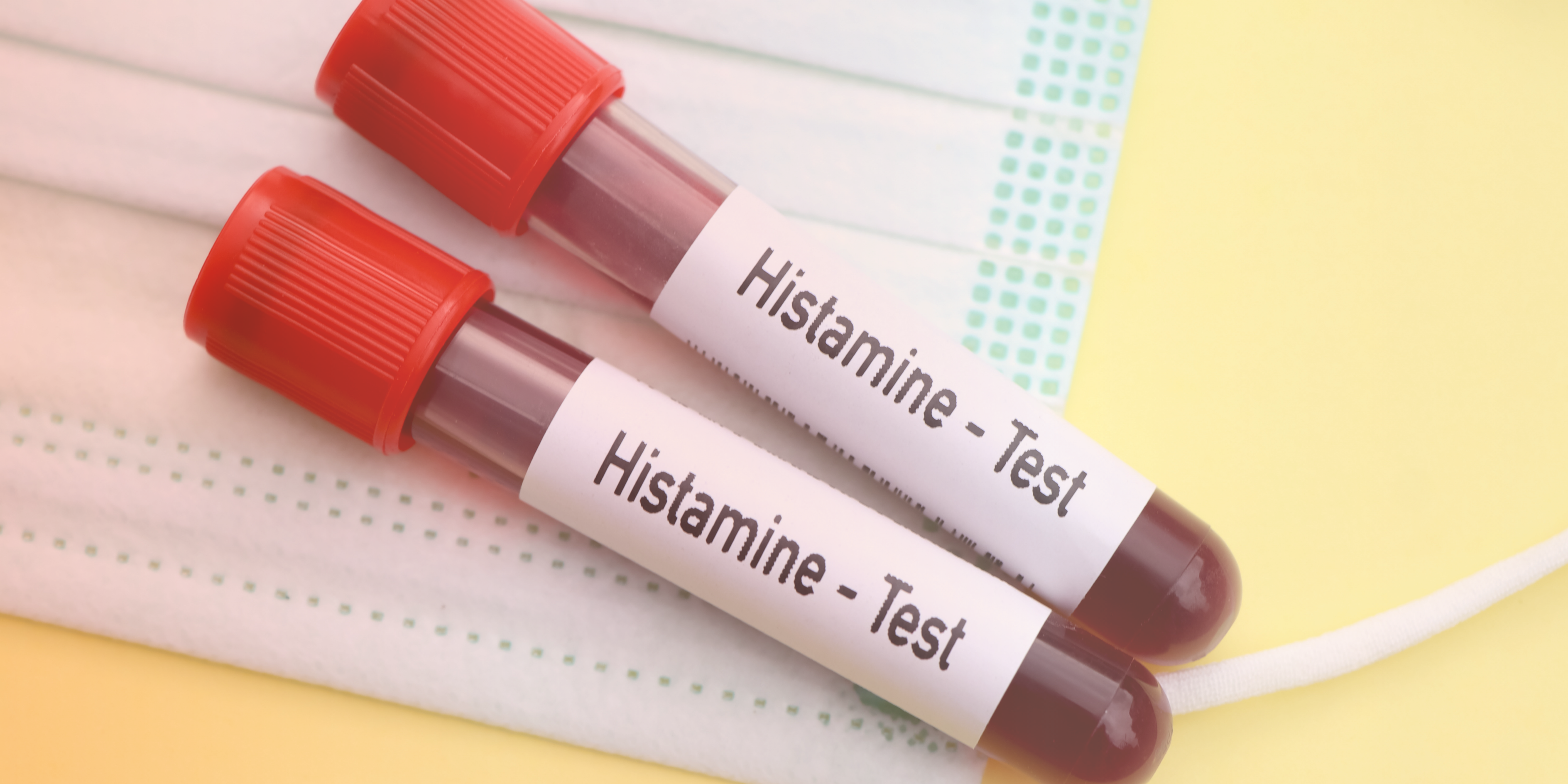 Two blood collection tubes with red caps lying on a dotted background. The tubes are labeled 'Histamine - Test' and contain what appears to be blood samples. The background has a soft yellow gradient and green dotted pattern visible.